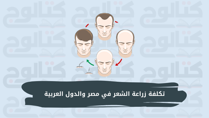 تكلفة زراعة الشعر في مصر والدول العربية 2022